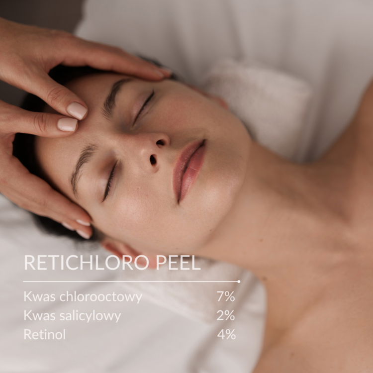 Retichloro Peel